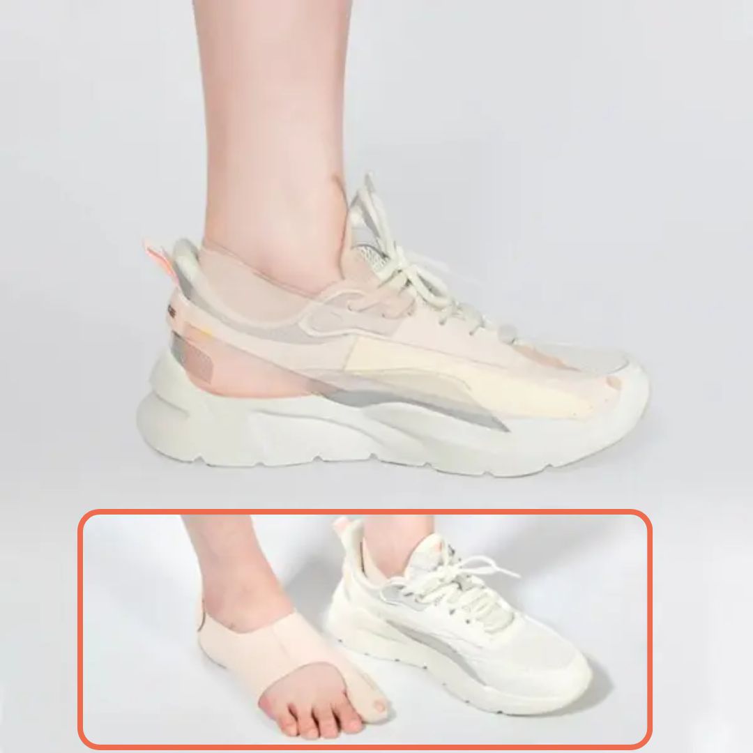 Bunion corrector voor pijnvrij bewegen