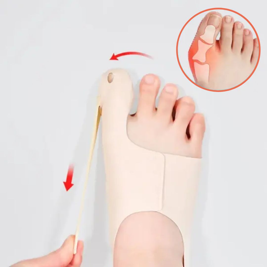 Bunion corrector voor pijnvrij bewegen
