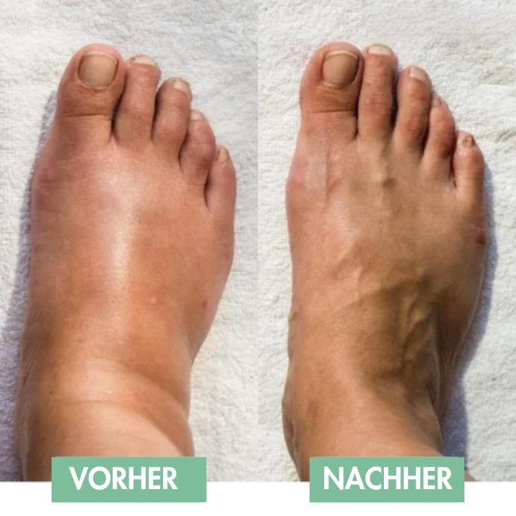 Innovatief EMS-voetmassageapparaat voor directe verlichting