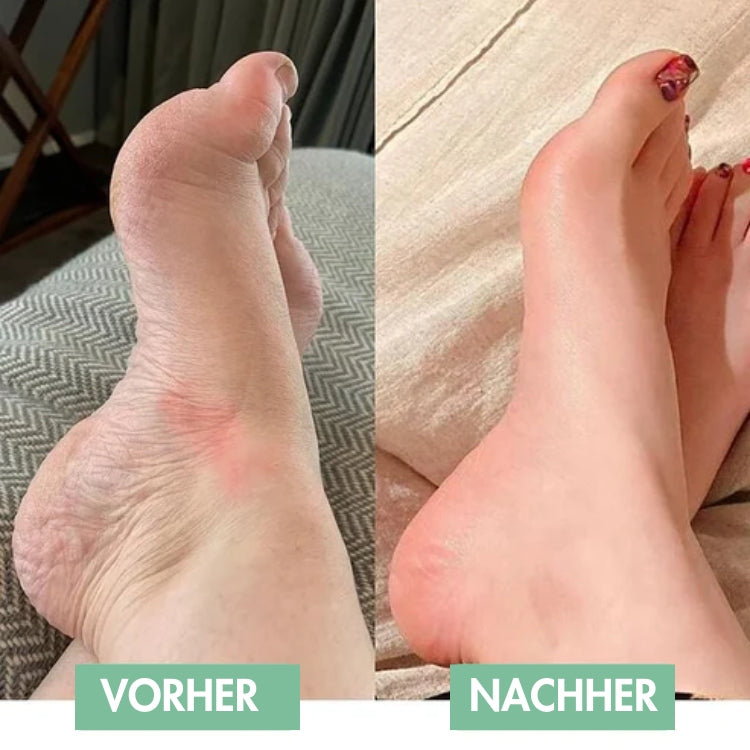 Innovatief EMS-voetmassageapparaat voor directe verlichting