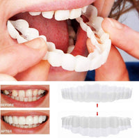 Snap-On Tanden Facings (Inclusief Boven- en Onderkaak)